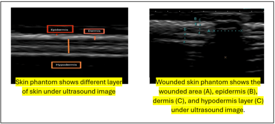 UTM - Figure 2